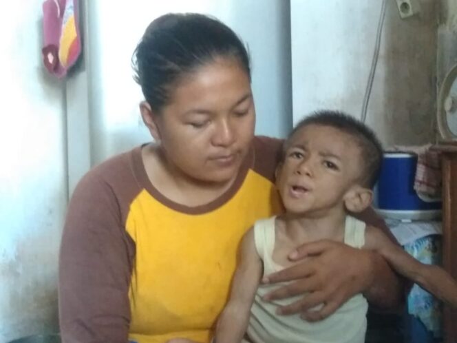 
Ulurkan Tangan Anda untuk Bantu Balita Penderita Epilepsi yang Kondisinya Kian Memprihatinkan ini